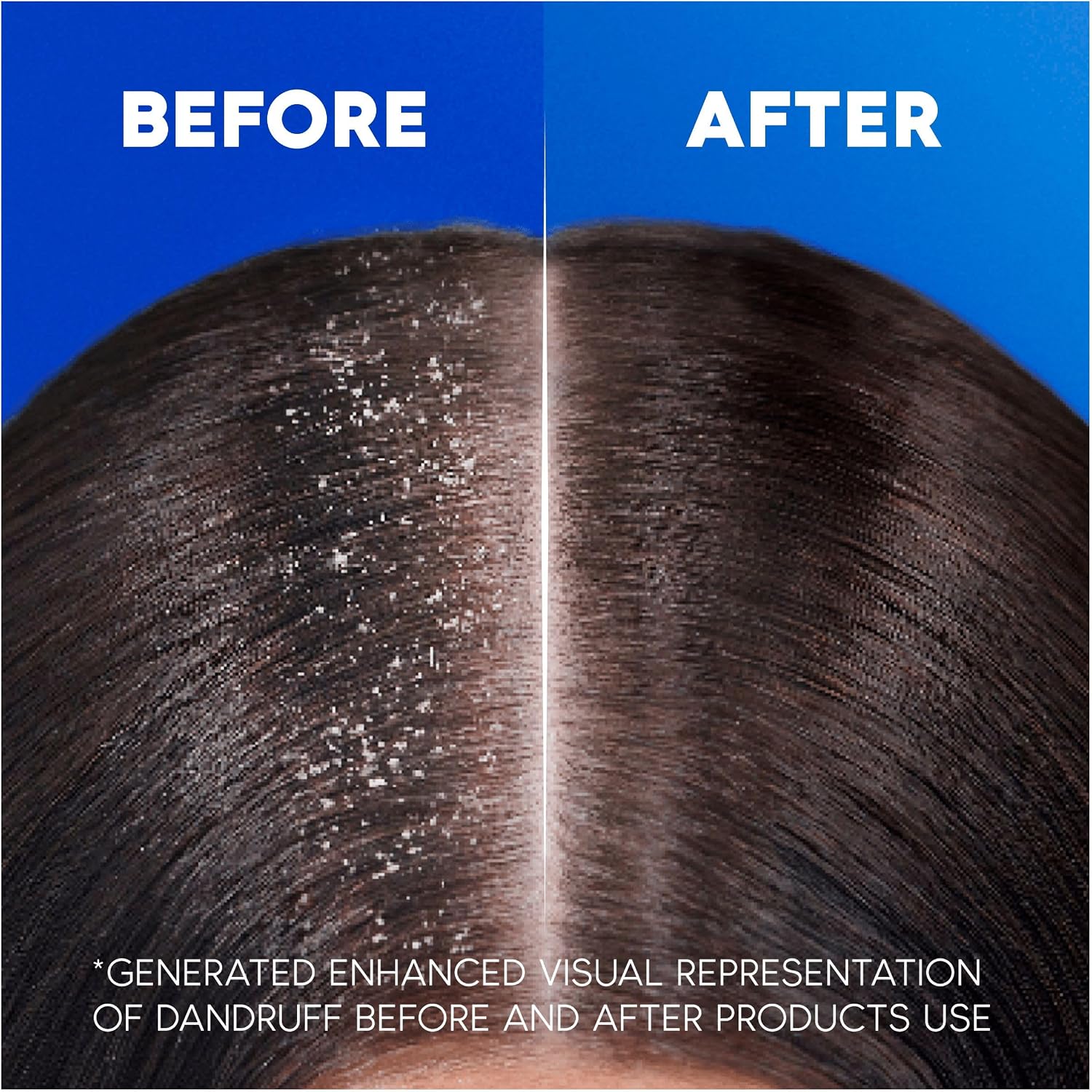 Head & Shoulders Citrus Fresh Anti Dandruff Shampoo For Greasy Hair, 1L | Up to 100% Flake Free, Clinically Proven, For Any Hair and Scalp Type, For Daily use, Clean Feeling. XXL Pump