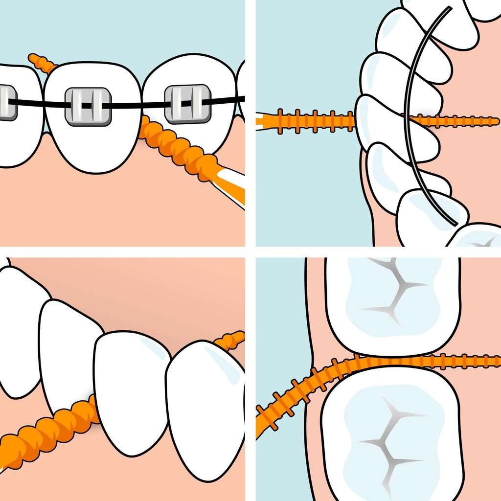 TePe EasyPick toothpicks, 60 orange ISO XS-S. Great for quick, easy cleaning between teeth